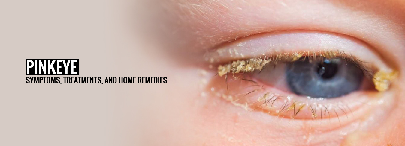 Pinkeye