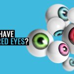 different-colored-eyes