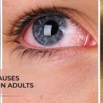 understanding-the-causes-of-eye