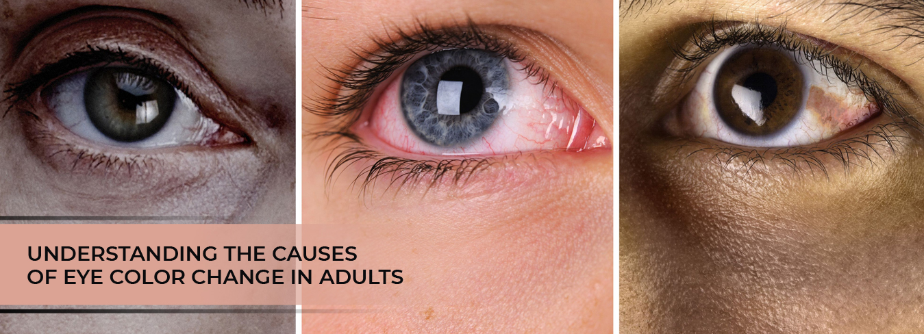 understanding-the-causes-of-eye