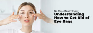 how to get rid of eye bags