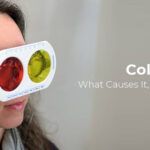 Eye specialist conducting a colour blindness test using red and yellow lenses for diagnosis